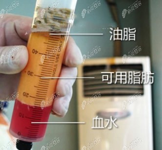 可用的脂肪颜色是黄色的