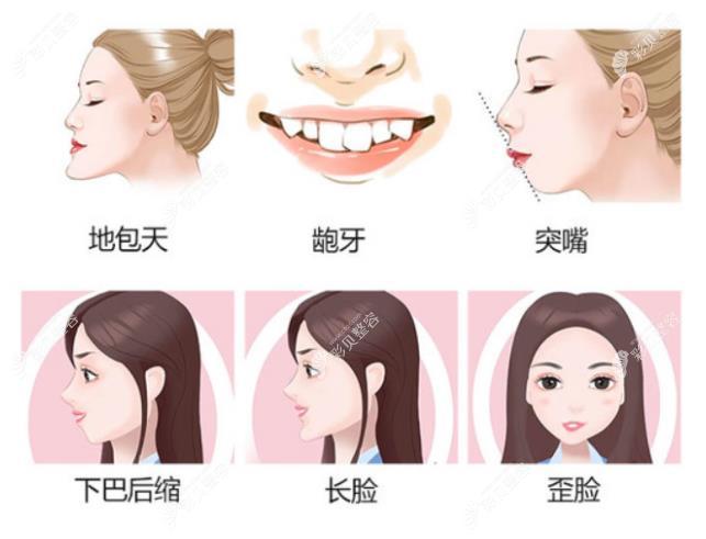 广州广大医院正颌手术怎么样