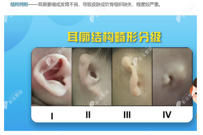 广州高尚余文林耳再造怎么样