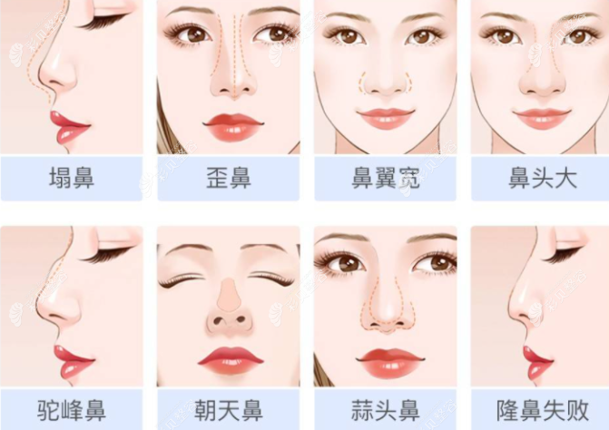 济南美思慕医院做鼻子价格