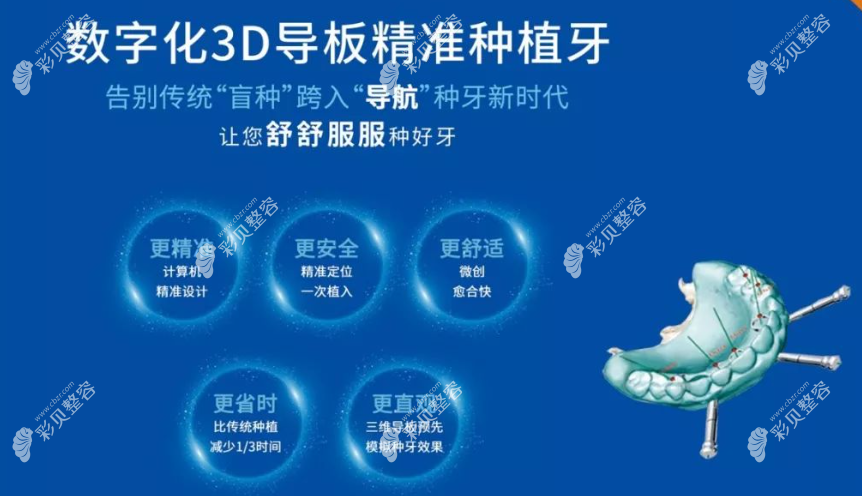 数字化导板种植牙的利和弊