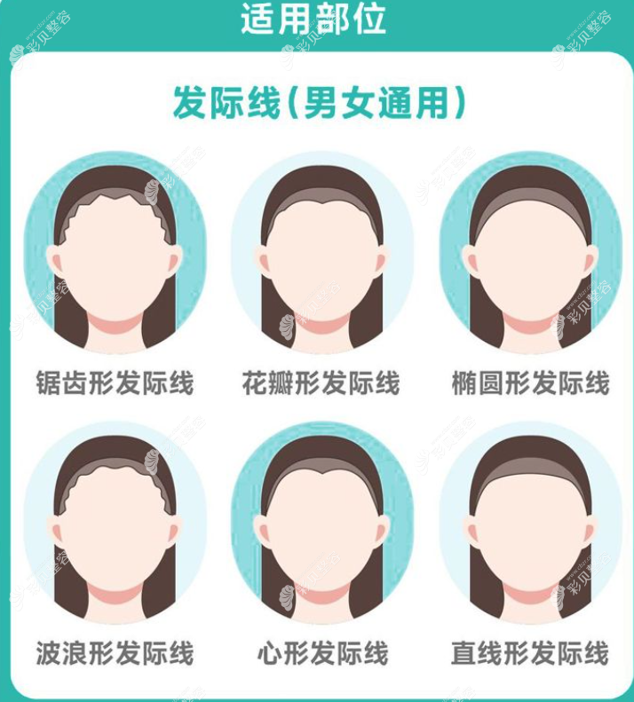 遵义毳森植发技术先进