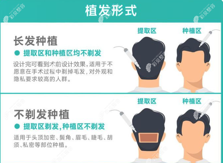 遵义毳森植发怎么样